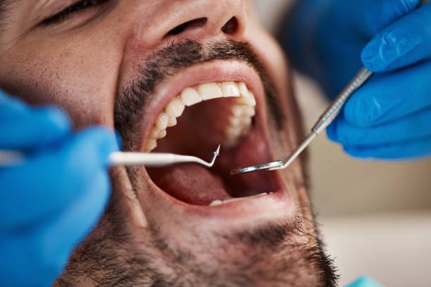 Best Urgent Tooth Repair  in Kempner, TX