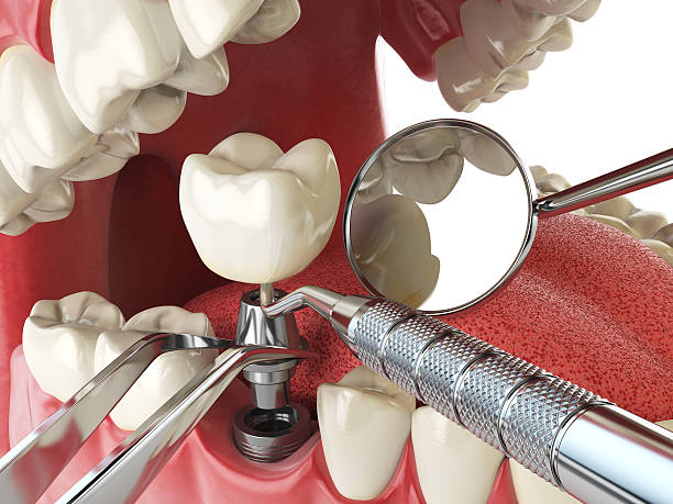 Best Cracked Tooth Emergency Dentist  in Kempner, TX